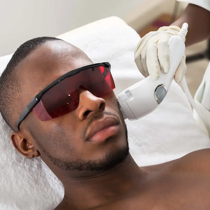 laser hair removal for men in nairobi