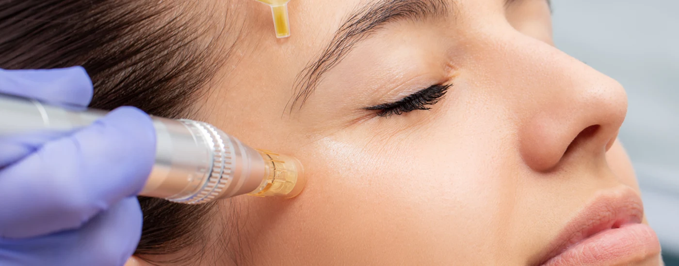 PRP Facial in Kenya • Dr. Stasch MediSpa